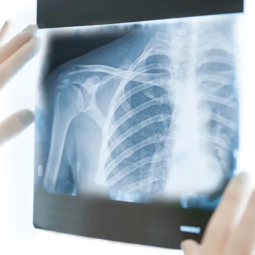 Radiografías clínicas especializadas en Querétaro